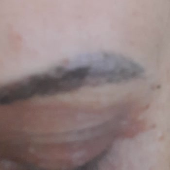 Aris Güzellik Merkezleri Hizmet Memnuniyetsizliği Memnun Kalmama