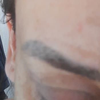 Aris Güzellik Merkezleri Hizmet Memnuniyetsizliği Memnun Kalmama