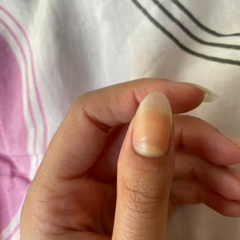 Flormar Yeşil Oje Tırnağımı Sararttı.