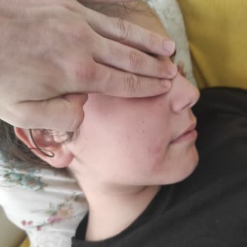 Dr. Öz Klinik Tayyar Öz Güneş Kremini Kullanınca Yüzüm Kızardı Ve Tahriş Oldu