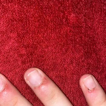 Esra Türkyılmaz Beauty İşlem Yaparken Parmaklarımızdan Oluyorduk