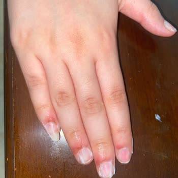 Esra Türkyılmaz Beauty İşlem Yaparken Parmaklarımızdan Oluyorduk