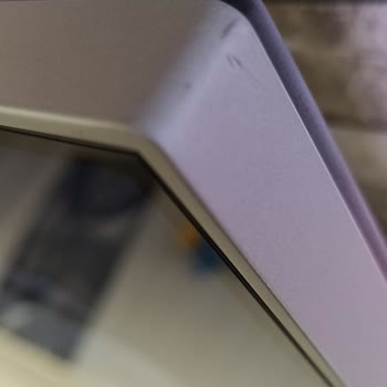 1 Senelik Philips TV Panel Değişimi Ve Tamir Süreci