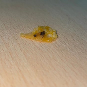 Lays Baharatlı Cipsten Böcek Çıktı