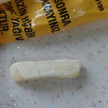 A101 Nimet Marka Donmuş Patates Kızarmasından Çıkan Kıl