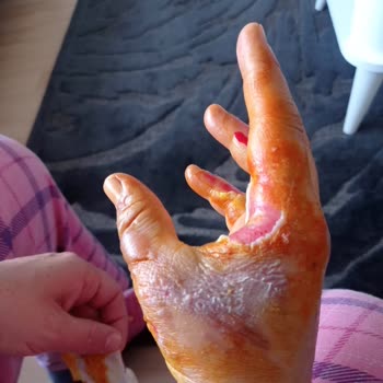 BİM Lavabo Açıcı Elimi Yaktı