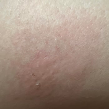 İzmir Büyükşehir Belediyesi Hiçbir Bölgede İlaçlama Yapmıyor