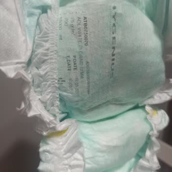 Molfix Bezin İçinden Etiket Çıkması, Sürekli Sızdırması!