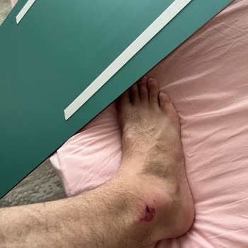 Enza Home Sürgülü Kapaktan Düşmesi