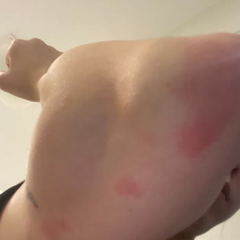 Yves Rocher Vanilyalı Vücut Sütü Kullanımında Kabarma Ve Kaşıntı