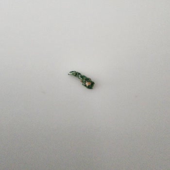 Uno Ekmek Ekmekte Yabancı Cisim