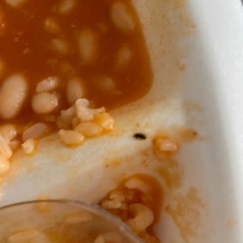 Bakırköy Dr. Sadi Konuk Eğitim Ve Araştırma Hastanesi Yemeklerde Böcek Çıktı