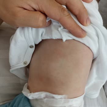 Bebelac Gold 3 Mama Alerjisi