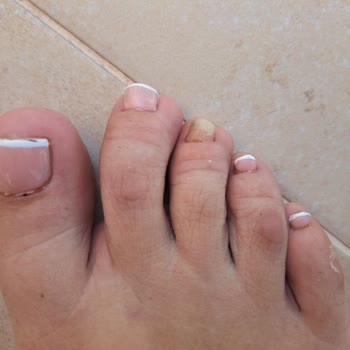 Atelier Nail Studio Suadiye Hem Maddi Hem Manevi Zarar