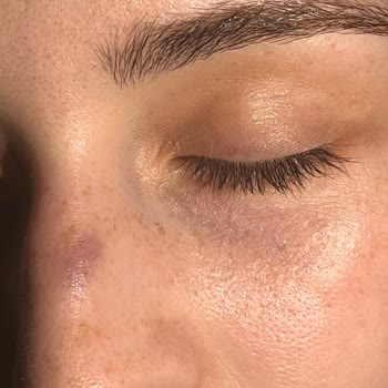 Stopever Burnumu Mahvetti Ürün Çok Kötü