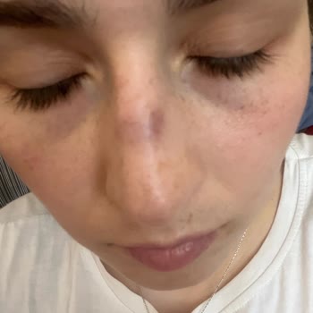 Stopever Burnumu Mahvetti Ürün Çok Kötü