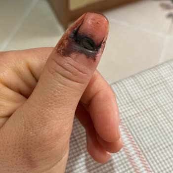 Medicana Hospitals Ataşehir Şikayeti