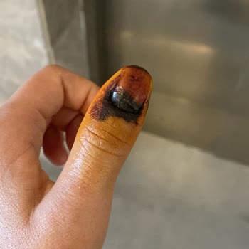 Medicana Hospitals Ataşehir Şikayeti