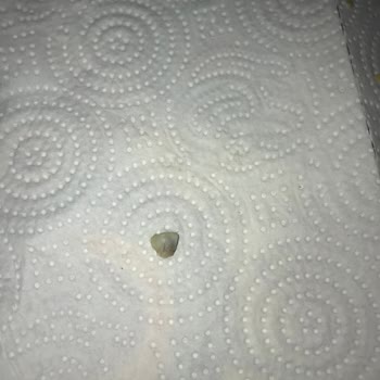 Keskinoğlu Markalı Şinitzel Çıkan Yabancı Madde