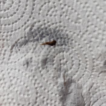 SHE Vec Hyaluronik Asit Bozuk Çıktı