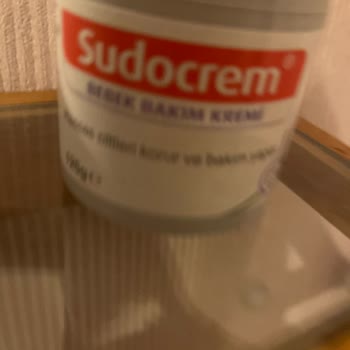 Sudocrem Annem 8 Yaşımdan Beri Kullanıyordu Ama Benim Vücudumda Yanma Yapıyor.