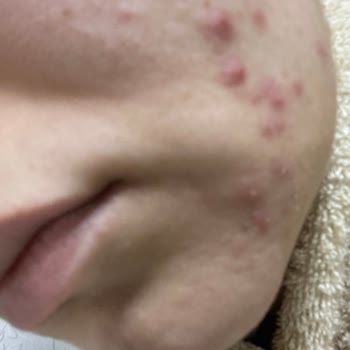 Rise & Shine Dilan Polat'ın Satın Aldığım Ürünleri Yüzümde Sivilce Çıkardı