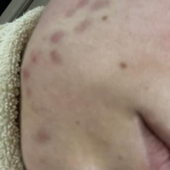 Rise & Shine Dilan Polat'ın Satın Aldığım Ürünleri Yüzümde Sivilce Çıkardı