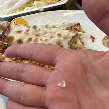 Trendyol Yemek - Cam Parçası Ve Fevri Müşteri Temsilcileri