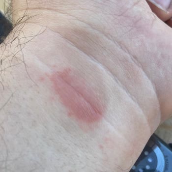 Irritating Apple Watch 7 Nike 41 Band