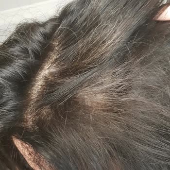 Koleston Naturals Saç Boyası Beyaz Saçları Tam Kapatamıyor!