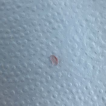 Avşar Maden Suyu Yeşil Elma İçinden Yabancı Cisim Çıktı