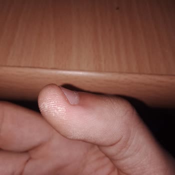 Schwarzkopf Palette Kalıcı Doğal Saç Açıcı Sprey Elde Leke Yaptı