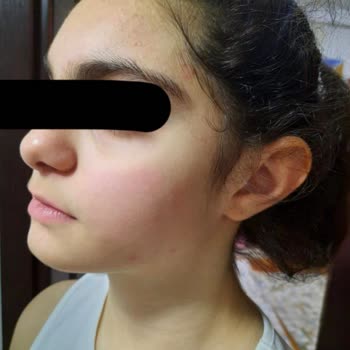 Yves Rocher Yuz Temizleme Jeli