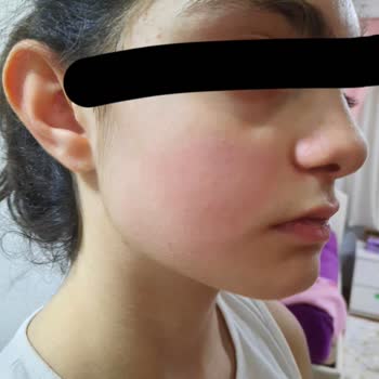 Yves Rocher Yuz Temizleme Jeli