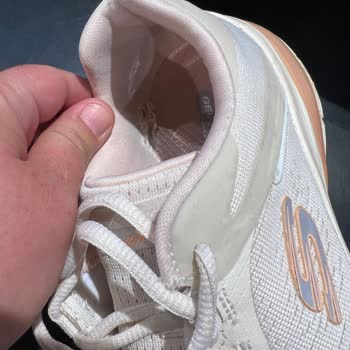 Skechers Hızlı Deformasyon Sorunu