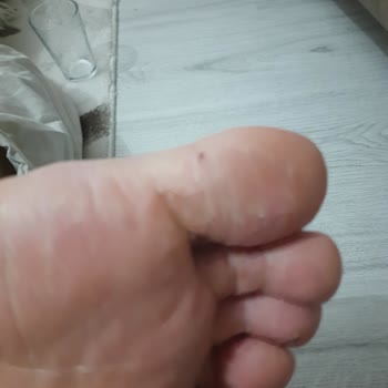 FLO Ayakkabı FLO Kalitesiz Malzeme Kullanımı