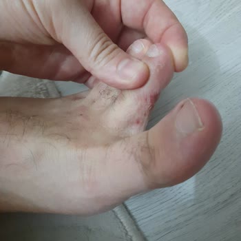 FLO Ayakkabı FLO Kalitesiz Malzeme Kullanımı
