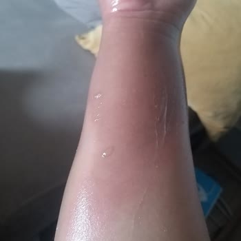 Aryıldız Düdüklü Tencerem Patladı
