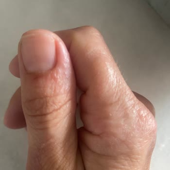 Fairy Ciltte Problem Yapıyor