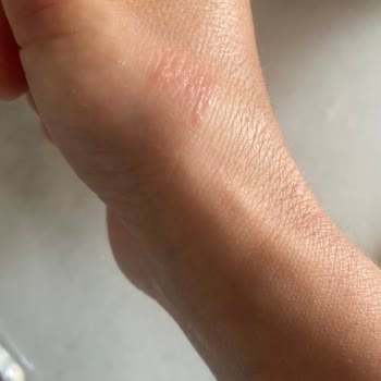 Fairy Ciltte Problem Yapıyor