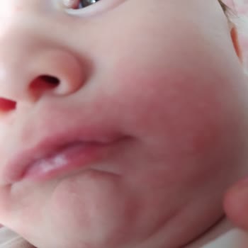 Hipp Organik Yulaflı Elmalı Sütlü Ürüne Alerji