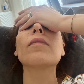 Esteworld Ataşehir Saç Lazeri!