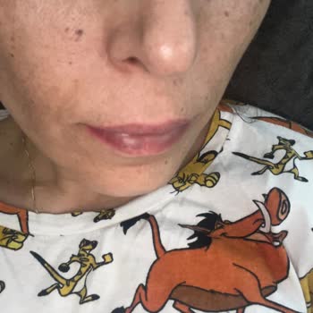 Esteworld Ataşehir Saç Lazeri!