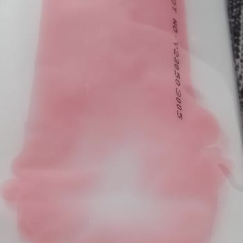 Remove Ağda, Bezin Etrafına Yayılmış