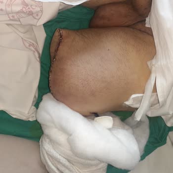 Kartal Dr. Lütfi Kırdar Şehir Hastanesi 20 Saat Oldu Pansuman Yapılmıyor