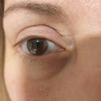 Op. Dr. Hüseyin Şimşek Başarısız Ameliyatı