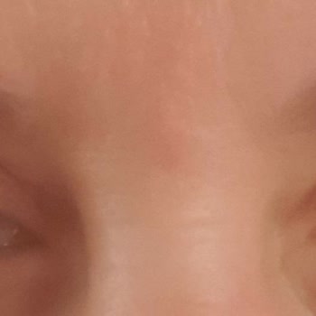 Op. Dr. Hüseyin Şimşek Başarısız Ameliyatı