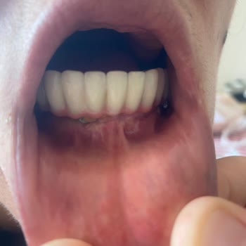 Mesam Ağız Ve Diş Sağlığı Polikliniği Parasını Fazlasıyla Verdiğimiz Halde Hizmet Alamıyoruz!