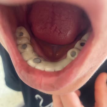 Mesam Ağız Ve Diş Sağlığı Polikliniği Parasını Fazlasıyla Verdiğimiz Halde Hizmet Alamıyoruz!