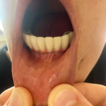 Mesam Ağız ve Diş Sağlığı Polikliniği Mesam Dis Klinigi